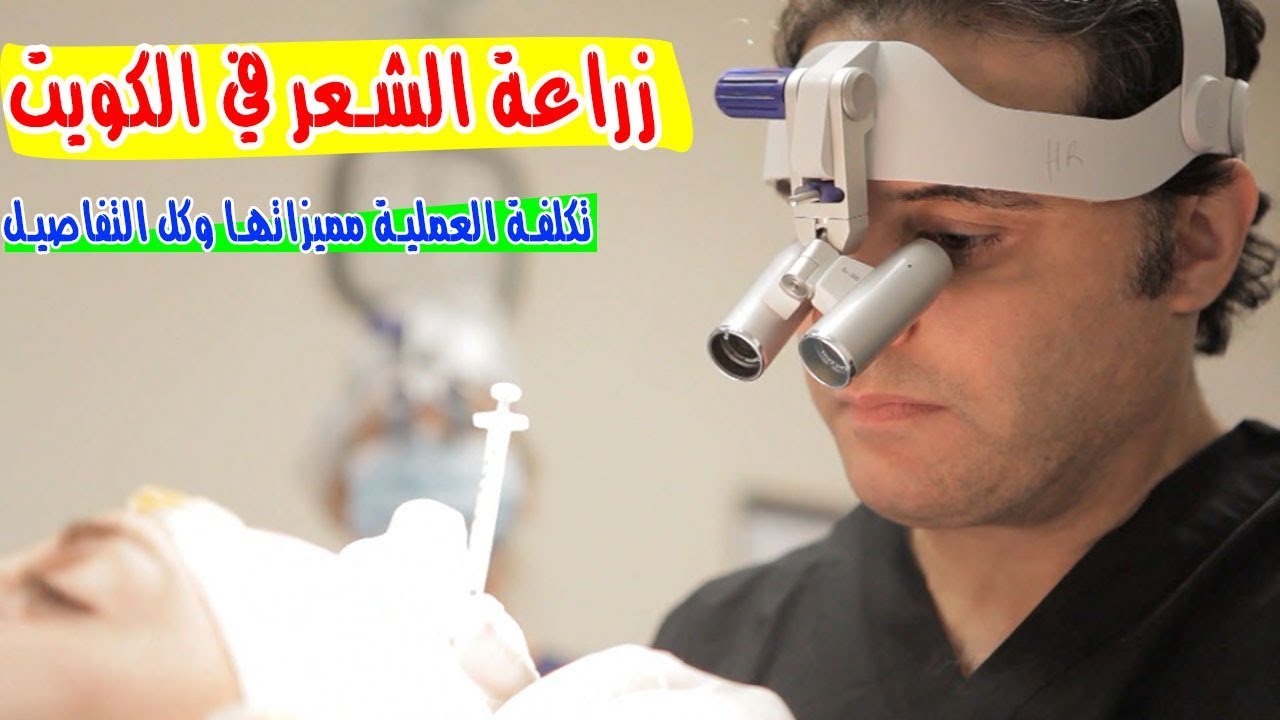 زراعة الشعر بالكويت - اهمية زراعة الشعر 11506