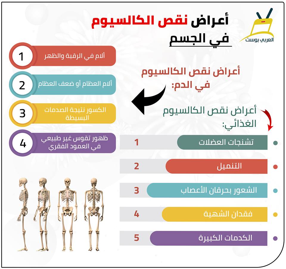 اعراض نقص الكالسيوم - كيف تعرف انك مصاب بنقص الكالسيوم 1637 2