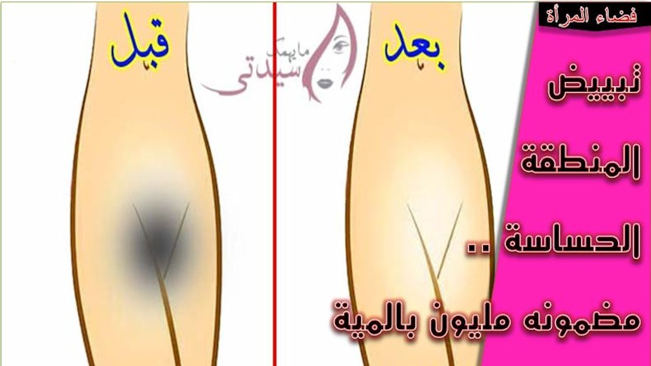 تبييض المناطق الحساسة , اقوي الوصفات لتفتيح المناطق الحساسية