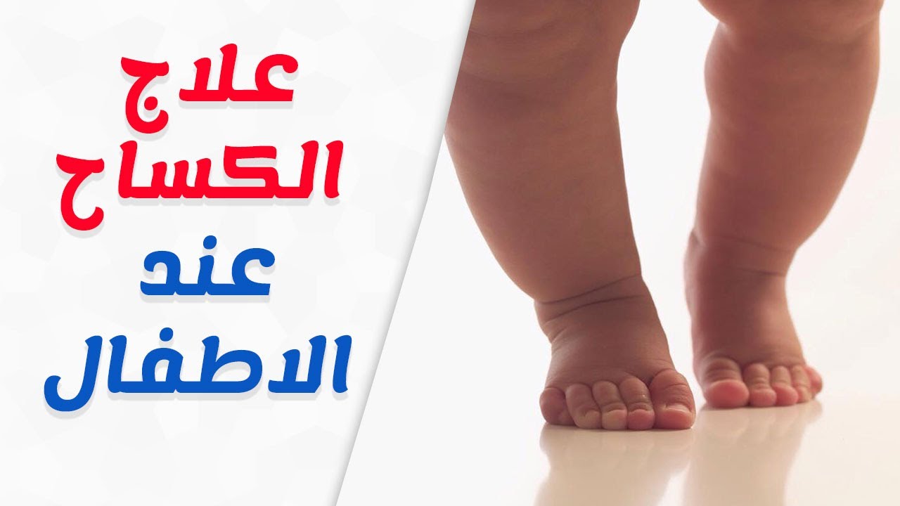 مرض الكساح - اعراض الكساح وما هو علاجه 4813 3