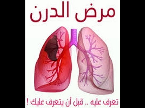 مرض الدرن - اعراضه و طرق علاجه 3766