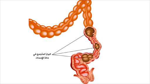 الموضوع ده متعب بجد - الامساك في رمضان 5756 1