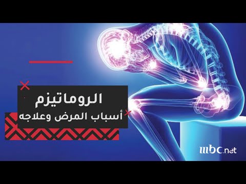 اعراض الروماتيزم - علامات اصابه الانسان بالروماتيزم 0 1