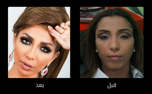 صور تجميل , صور مذهلة قبل و بعد التجميل لن تصدق الفرق