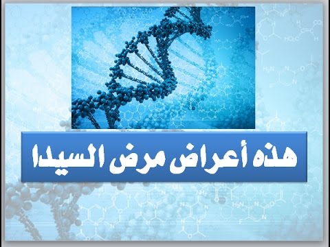 مرض السيدا - ماهو مرض السيدا 0 28