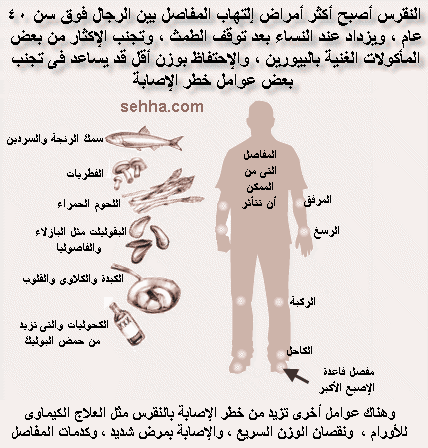 اعراض النقرس - طرق الوقاية و العلاج منه 3881