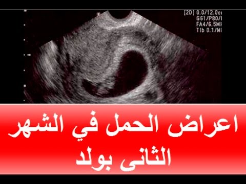 علامات الحمل بولد في الشهر الثاني , طرق معرفة نوع الجنين الذكر مبكرا