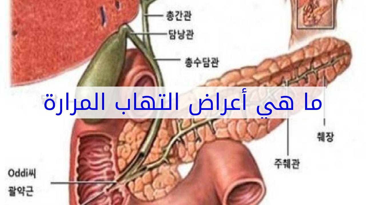 اعراض المرارة , ماهي اعراض المرارة