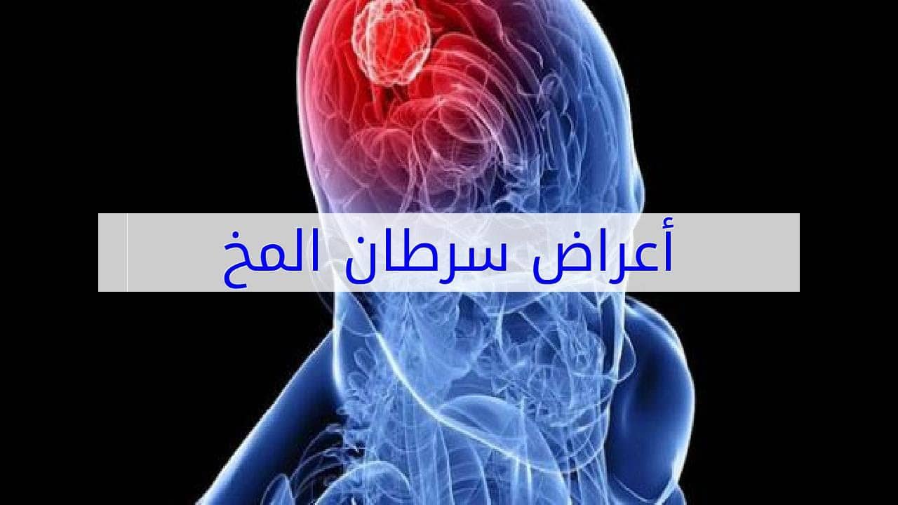 اعراض ورم المخ - ماهي الاعراض السرطان في المخ 11445 4