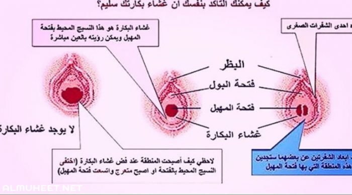 كيف اعرف اني عذراء , كيف اعرف اني عذراء بالصور