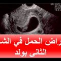 1687 3 علامات الحمل بولد في الشهر الثاني - طرق معرفة نوع الجنين الذكر مبكرا سهام